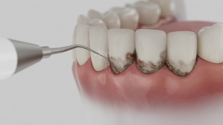 Reliable Dental Implants contractor in Four Square Mile, CO by Smile Center Dentistry